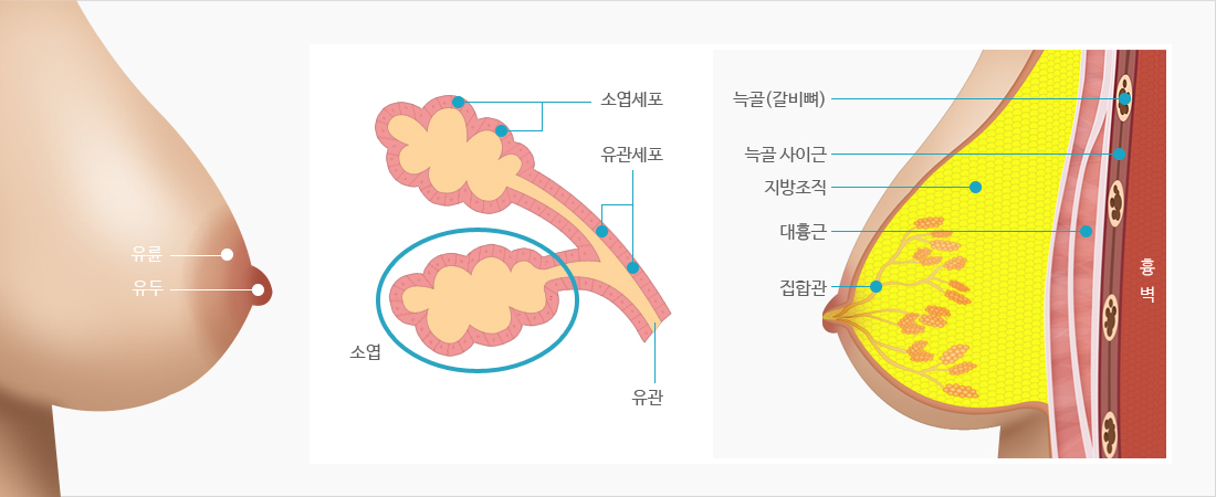 유방암::유항맥서울외과